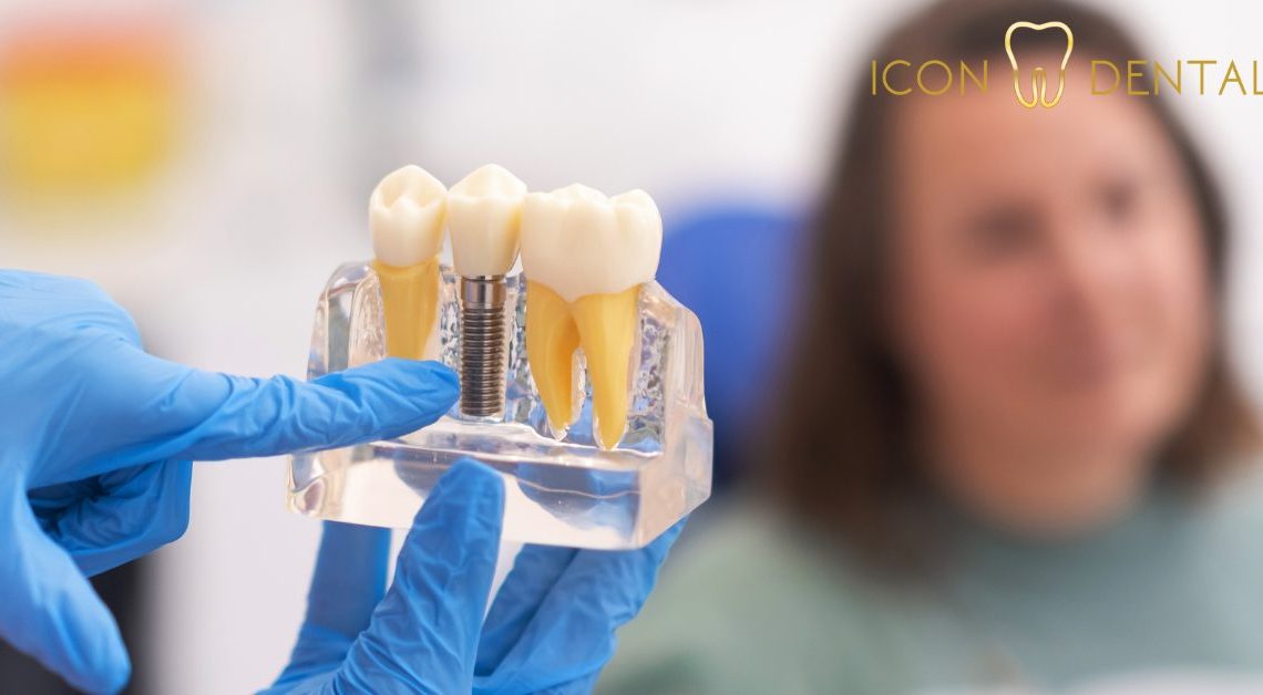dental implant cost malaysia