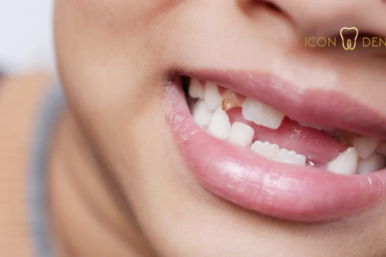 implant tooth cost in malaysia