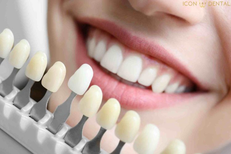 teeth whitening price