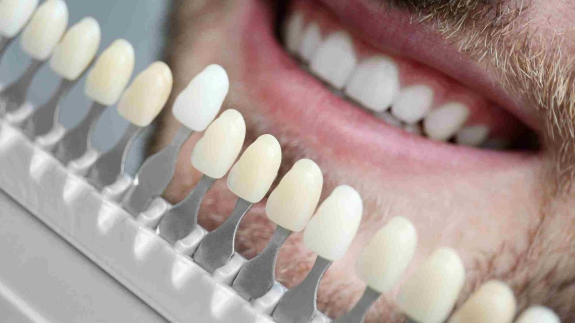 dental services